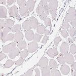 HDAC1 Antibody in Immunohistochemistry (Paraffin) (IHC (P))