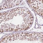 HDAC1 Antibody in Immunohistochemistry (Paraffin) (IHC (P))