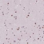 BRD4 Antibody in Immunohistochemistry (Paraffin) (IHC (P))