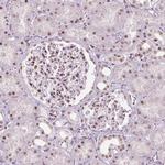 BRD4 Antibody in Immunohistochemistry (Paraffin) (IHC (P))