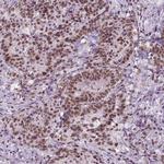 BRD4 Antibody in Immunohistochemistry (Paraffin) (IHC (P))