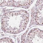 BRD4 Antibody in Immunohistochemistry (Paraffin) (IHC (P))