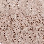 GRP94 Antibody in Immunohistochemistry (Paraffin) (IHC (P))