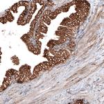 GRP94 Antibody in Immunohistochemistry (Paraffin) (IHC (P))