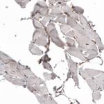 GRP94 Antibody in Immunohistochemistry (Paraffin) (IHC (P))