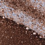 S100B Antibody in Immunohistochemistry (Paraffin) (IHC (P))