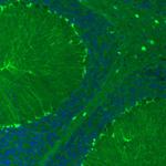 S100B Antibody in Immunohistochemistry (Paraffin) (IHC (P))