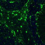 S100B Antibody in Immunohistochemistry (Paraffin) (IHC (P))