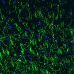 MBP Antibody in Immunohistochemistry (Paraffin) (IHC (P))