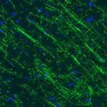 MBP Antibody in Immunohistochemistry (Paraffin) (IHC (P))