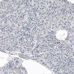 CNPase Antibody in Immunohistochemistry (Paraffin) (IHC (P))