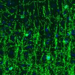 CNPase Antibody in Immunohistochemistry (Paraffin) (IHC (P))