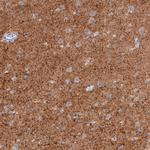 VGLUT2 Antibody in Immunohistochemistry (Paraffin) (IHC (P))