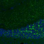 VGLUT2 Antibody in Immunohistochemistry (Paraffin) (IHC (P))