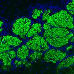 VGLUT2 Antibody in Immunohistochemistry (Paraffin) (IHC (P))