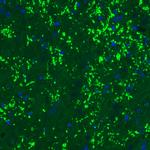 VGLUT2 Antibody in Immunohistochemistry (Paraffin) (IHC (P))