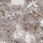 Laminin beta-1 Antibody in Immunohistochemistry (Paraffin) (IHC (P))