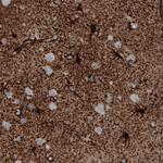 Glutamine Synthetase Antibody in Immunohistochemistry (Paraffin) (IHC (P))