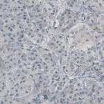 Glutamine Synthetase Antibody in Immunohistochemistry (Paraffin) (IHC (P))