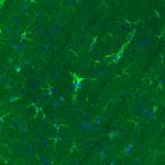 Glutamine Synthetase Antibody in Immunohistochemistry (Paraffin) (IHC (P))