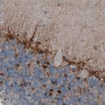 Glutamine Synthetase Antibody in Immunohistochemistry (Paraffin) (IHC (P))