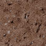 Glutamine Synthetase Antibody in Immunohistochemistry (Paraffin) (IHC (P))