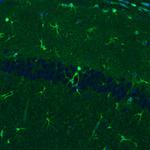 Glutamine Synthetase Antibody in Immunohistochemistry (Paraffin) (IHC (P))