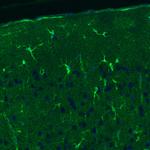 Glutamine Synthetase Antibody in Immunohistochemistry (Paraffin) (IHC (P))