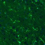 Glutamine Synthetase Antibody in Immunohistochemistry (Paraffin) (IHC (P))