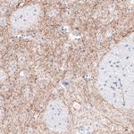 Tyrosine Hydroxylase Antibody in Immunohistochemistry (Paraffin) (IHC (P))