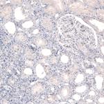 Tyrosine Hydroxylase Antibody in Immunohistochemistry (Paraffin) (IHC (P))