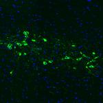 Tyrosine Hydroxylase Antibody in Immunohistochemistry (Paraffin) (IHC (P))