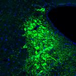 Tyrosine Hydroxylase Antibody in Immunohistochemistry (Paraffin) (IHC (P))