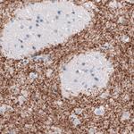 Dopamine Transporter Antibody in Immunohistochemistry (Paraffin) (IHC (P))