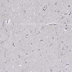 Dopamine Transporter Antibody in Immunohistochemistry (Paraffin) (IHC (P))