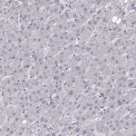 Dopamine Transporter Antibody in Immunohistochemistry (Paraffin) (IHC (P))