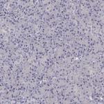 Dopamine Transporter Antibody in Immunohistochemistry (Paraffin) (IHC (P))