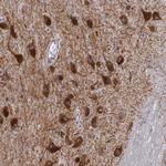 Dopamine Transporter Antibody in Immunohistochemistry (Paraffin) (IHC (P))