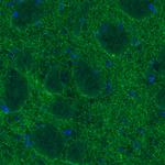 Dopamine Transporter Antibody in Immunohistochemistry (Paraffin) (IHC (P))