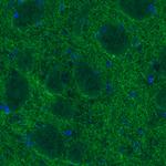 Dopamine Transporter Antibody in Immunohistochemistry (Paraffin) (IHC (P))