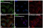 Laminin gamma-1 Antibody in Immunocytochemistry (ICC/IF)