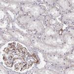 Laminin gamma-1 Antibody in Immunohistochemistry (Paraffin) (IHC (P))