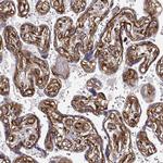 Laminin gamma-1 Antibody in Immunohistochemistry (Paraffin) (IHC (P))