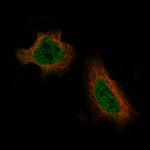 DAXX Antibody in Immunocytochemistry (ICC/IF)