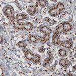 DAXX Antibody in Immunohistochemistry (Paraffin) (IHC (P))