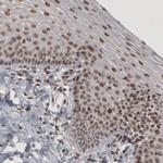 DAXX Antibody in Immunohistochemistry (Paraffin) (IHC (P))