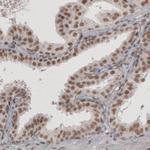 DAXX Antibody in Immunohistochemistry (Paraffin) (IHC (P))