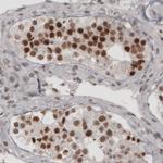 DAXX Antibody in Immunohistochemistry (Paraffin) (IHC (P))