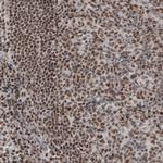 DAXX Antibody in Immunohistochemistry (Paraffin) (IHC (P))