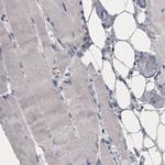 OATP8 Antibody in Immunohistochemistry (Paraffin) (IHC (P))